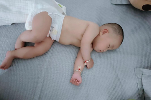 洛阳宝宝脸上有白色斑块 洛阳宝宝脸上有白色斑块